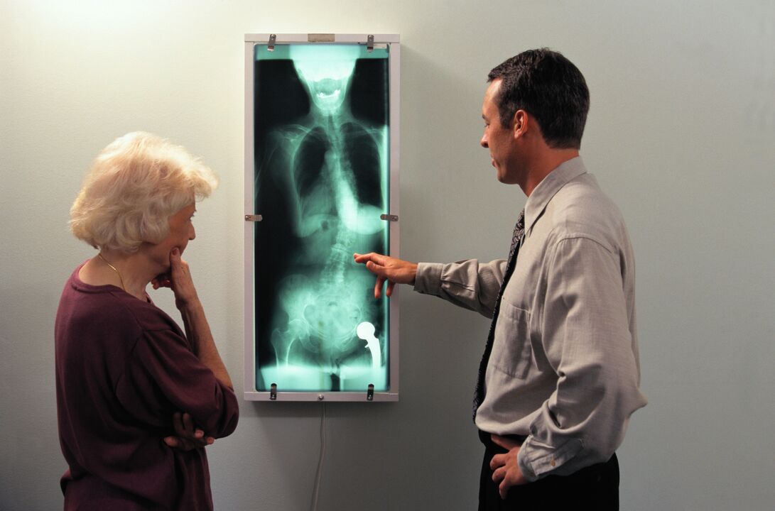 puusaliigese valu röntgendiagnoos