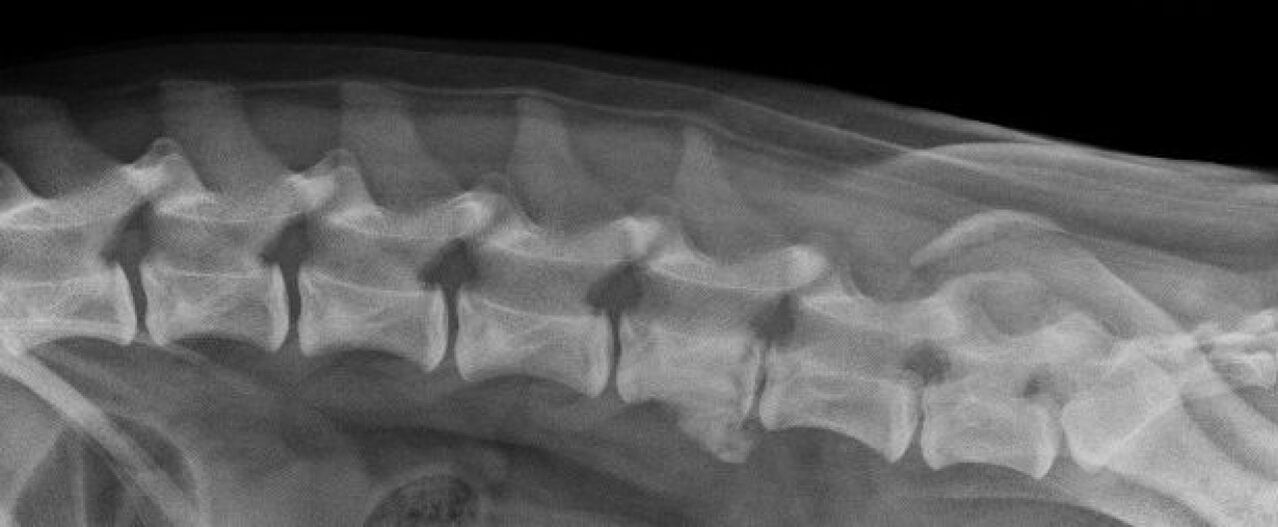 Rindkere lülisamba osteokondroosi ilmingud röntgenpildil